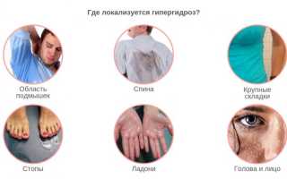 15 средств от потливости ног – что делать, когда потеют ноги?